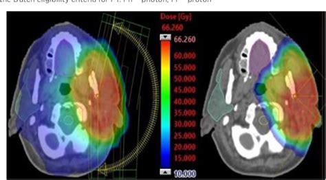 Figure 1 From Clinical Outcome After Pencil Beam Scanning Proton Therapy And Dysphagia