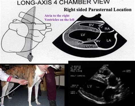 Echocardiography Flashcards Quizlet