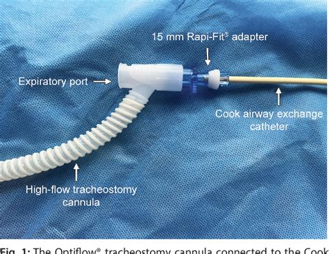 high flow tracheal oxygenation  airway exchange catheter