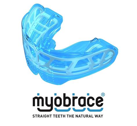 Myobrace : r/orthotropics