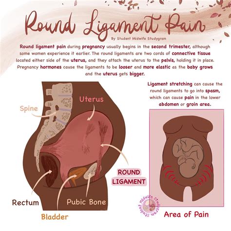 Pelvic Round Ligament Pain In Pregnancy Symphysis Pubis Dysfunction