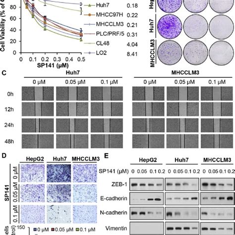 In vitro activity of SP141 in human HCC cells. (A) Non-malignant human ...