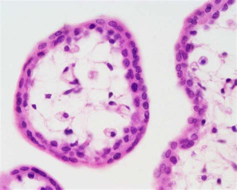 Bgda Practical Placenta Villi Development Embryology