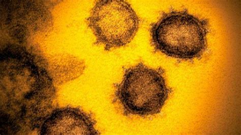 Cepa De Coronavirus Altamente Contagiosa Se Extendió En 15 Países