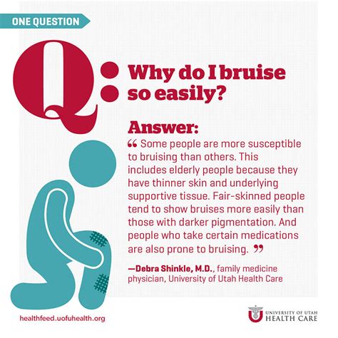 Why Do I Bruise So Easily? | University of Utah Health