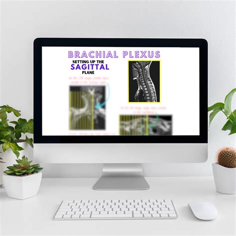 MRI Planning, MRI Positioning, Mri Neuro, Mri Study Guide, Mri Notes