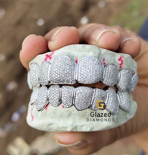 Moissanite Grillz | Custom Fully Iced Out Moissanite Diamond Grillz