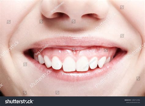 Perfect Human Smiles