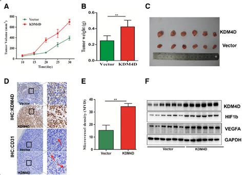 Kdm D Overexpression Promotes Gist Cell Proliferation And Angiogenesis