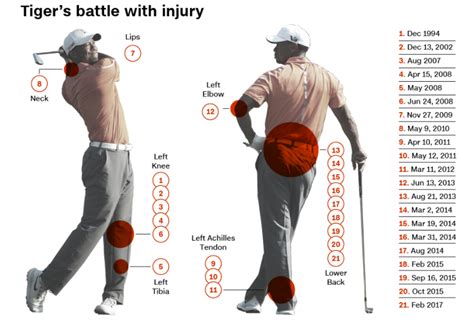 Tiger Woods entire injury history : golf