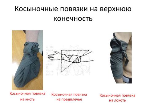 Виды повязок. Косыночная повязка. Техника наложения косыночных повязок ...