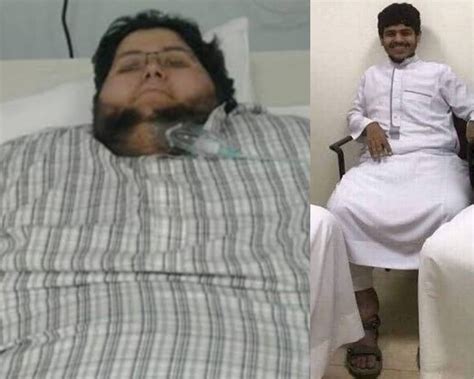 World’s heaviest man unrecognisable as he loses 542kg after offer from