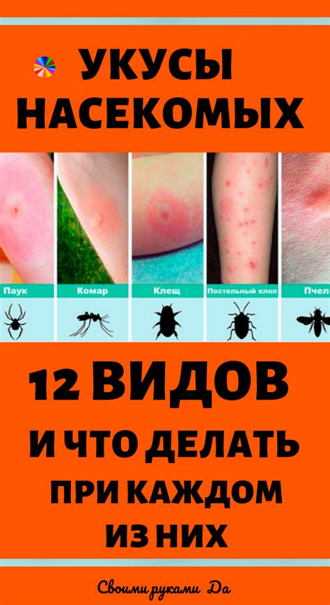 Укусы насекомых: 12 видов и что делать при каждом из них в домашних ...