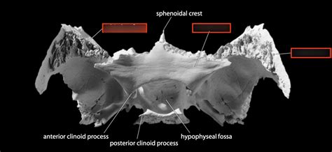 Sphenoid Bone Superior Endocranial Diagram Quizlet