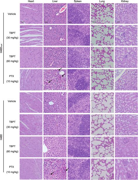 Histopathological Examination Of The Major Organs From Tbptor