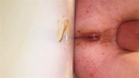 Zucchini Gay Bizarre Porn At ThisVid Tube