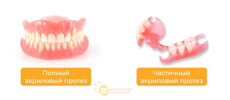 Акриловые протезы зубные, цены на полный и частичный протез из акрила