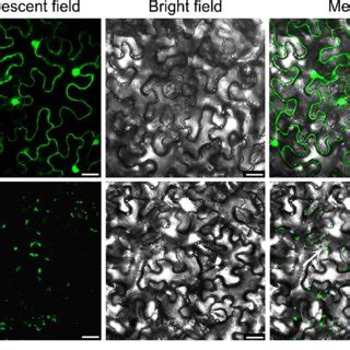 Subcellular Localization Of SRBSDV P9 1 Fused To GFP GFP P9 1 And