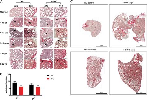 Ecm Remodeling In Lung Tissue After Btt A Ecm Regulation And Collagen