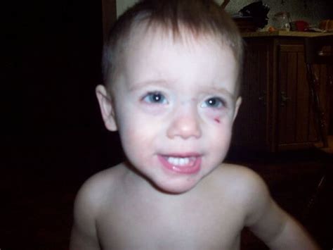 Stepmom Feeds Boy Laxatives And Pours Hot Sauce Down His Throat Out Of Jealousy Page 2 Of 2