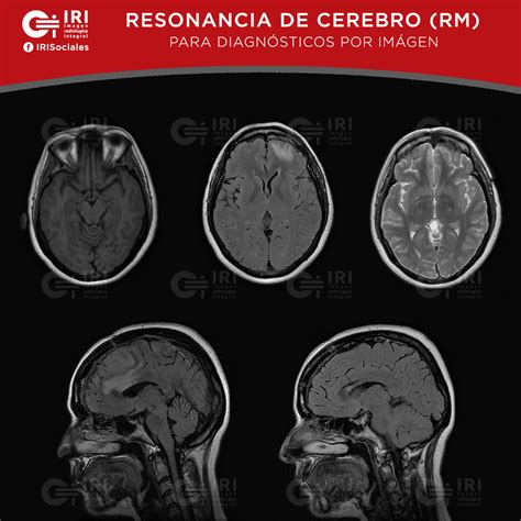 La Resonancia de... - Imagen Radiologica Integral Tijuana