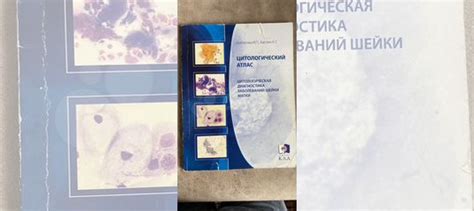 Цитологический атлас: цитологическая диагностика... купить в Челябинске ...