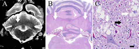 A Transverse T Weighed Turbo Spin Echo Mr Image At The Level Of The