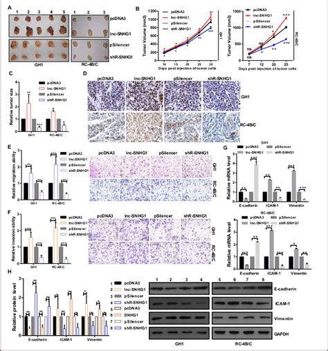 Lnc Snhg1 Facilitates Tumor Growth And Promotes Cell Migration