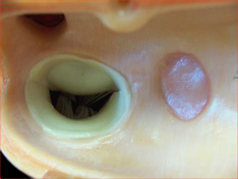 heart fossa ovalis diagram quizlet
