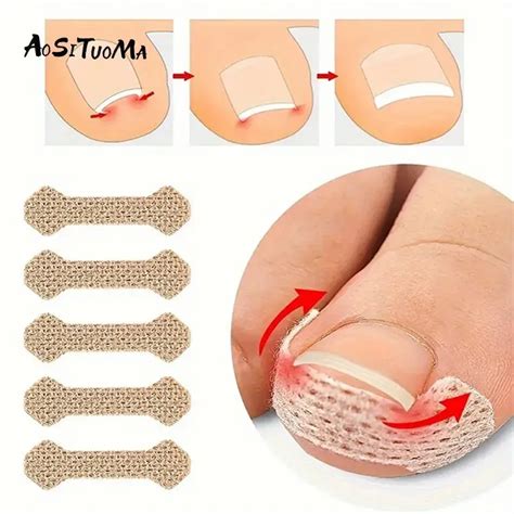 10 шт., корректирующие полоски для вросших ногтей | AliExpress