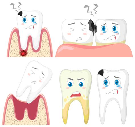 Unhealthy Teeth Solutions Rescuing Your Smile