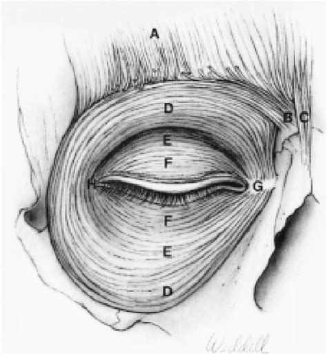Figure 1 From Abnormalities Of Eyelid Position And Function Semantic