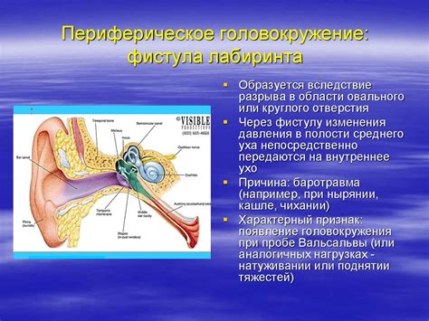 Головокружение и расстройства равновесия - презентация онлайн