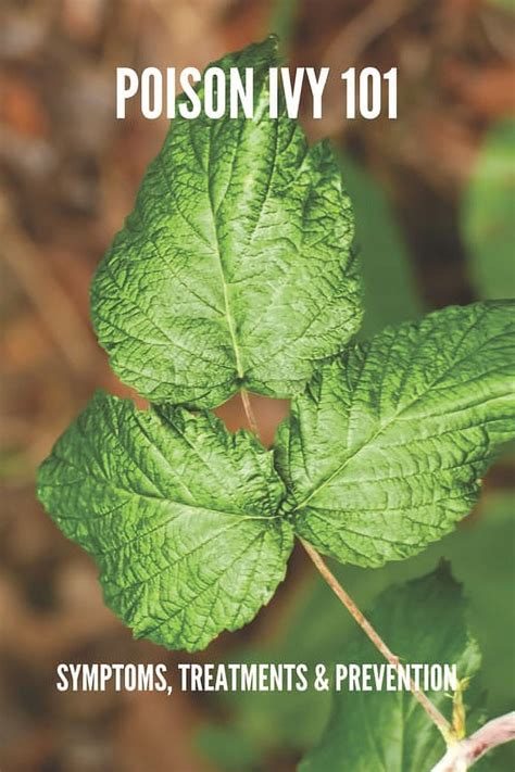 Poison Ivy 101 Symptoms Treatments And Prevention Poison Ivy Treatment