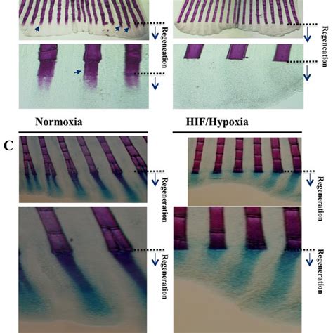 Maintained Hypertrophic Cartilage Formation And Inhibition Of Bone