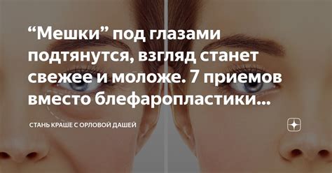 “Мешки” под глазами подтянутся, взгляд станет свежее и моложе. 7 ...