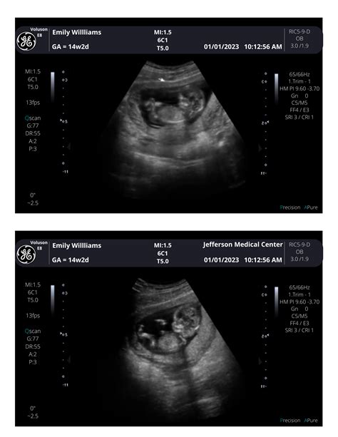 Customizable Digital Ultrasound Downloads | Fake Sonogram Picture