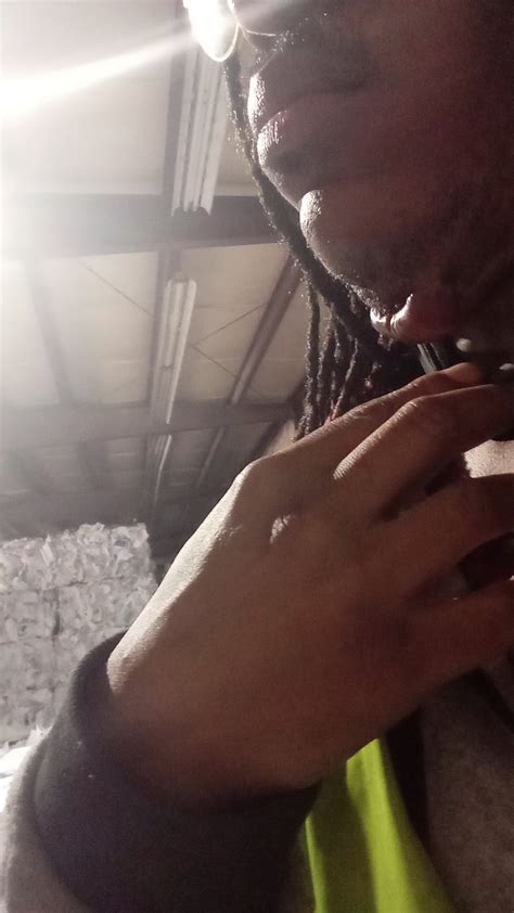 Keloids on jawline area : r/Keloids