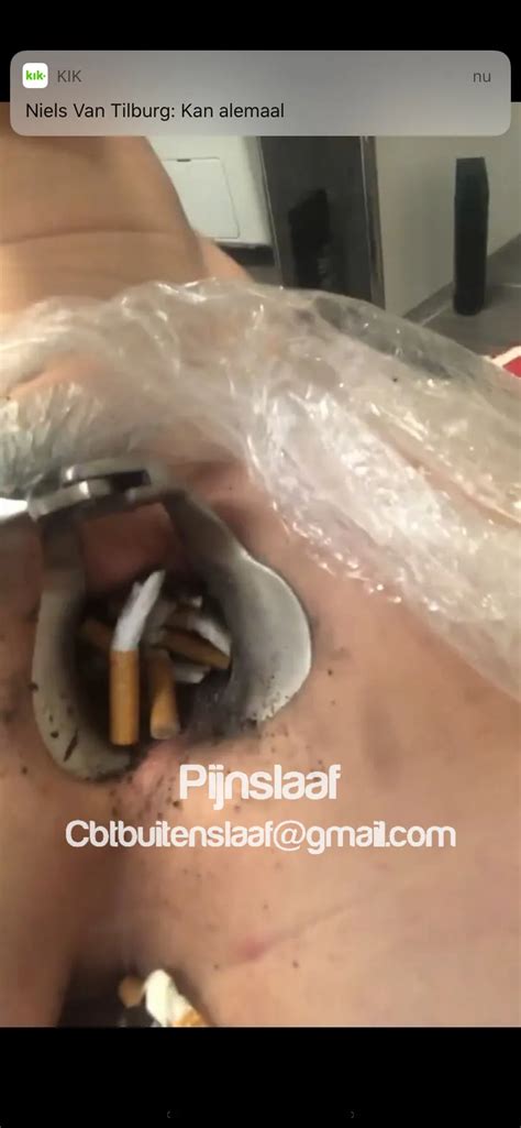 Fire Torture 5 Nude Pics XHamster