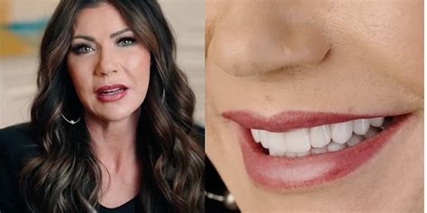 Kristi Noem shares video about dental work Smile Texas | Blaze Media