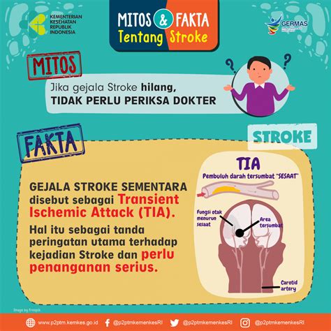 Benarkah Jika Gejala Stroke Hilang Tidak Perlu Periksa Ke Dokter