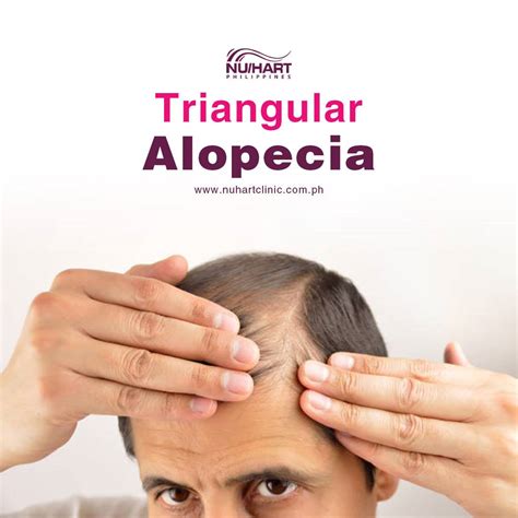 Congenital Nuhart Hair Restoration Philippines
