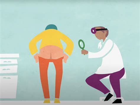 Treating Precancerous Anal Growths Cuts Risk Of Anal Cancer NCI