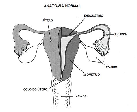 Utero Em Anteversoflexão O Que é - RETOEDU