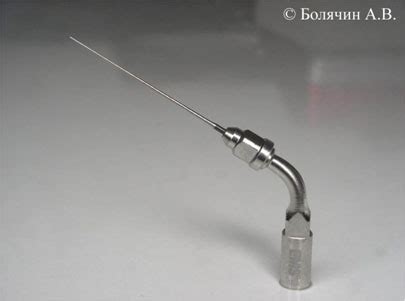 Современные принципы и методики ирригации корневых каналов