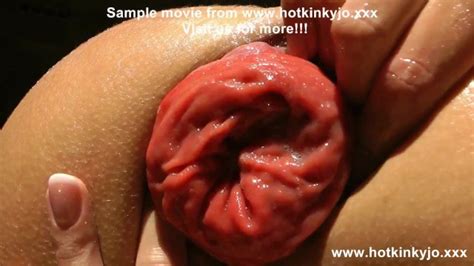 Hotkinkyjo Standing In Light Take Huge Black Dildo From Mrhankey In Her Ass Anal Prolapse Outdoor