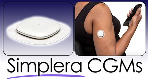 Medtronic S New Simplera Cgms Explained Youtube