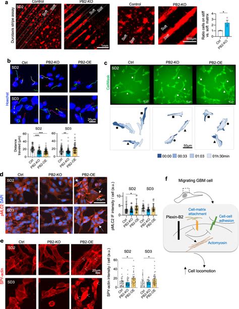 Plexin B2 Facilitates Glioblastoma Infiltration By Modulating Cell