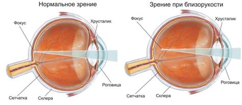 Глазные заболевания у человека список, симптомы - Центр микрохирургии ...