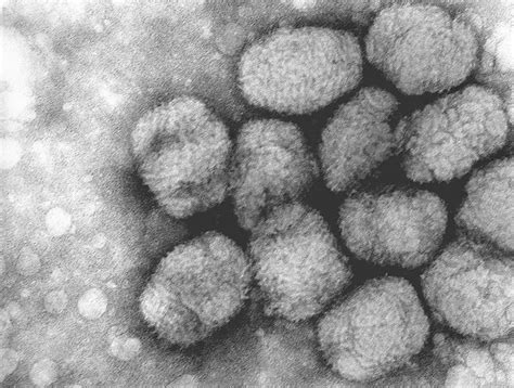 Free Picture Transmission Electron Micrograph Smallpox Viruses